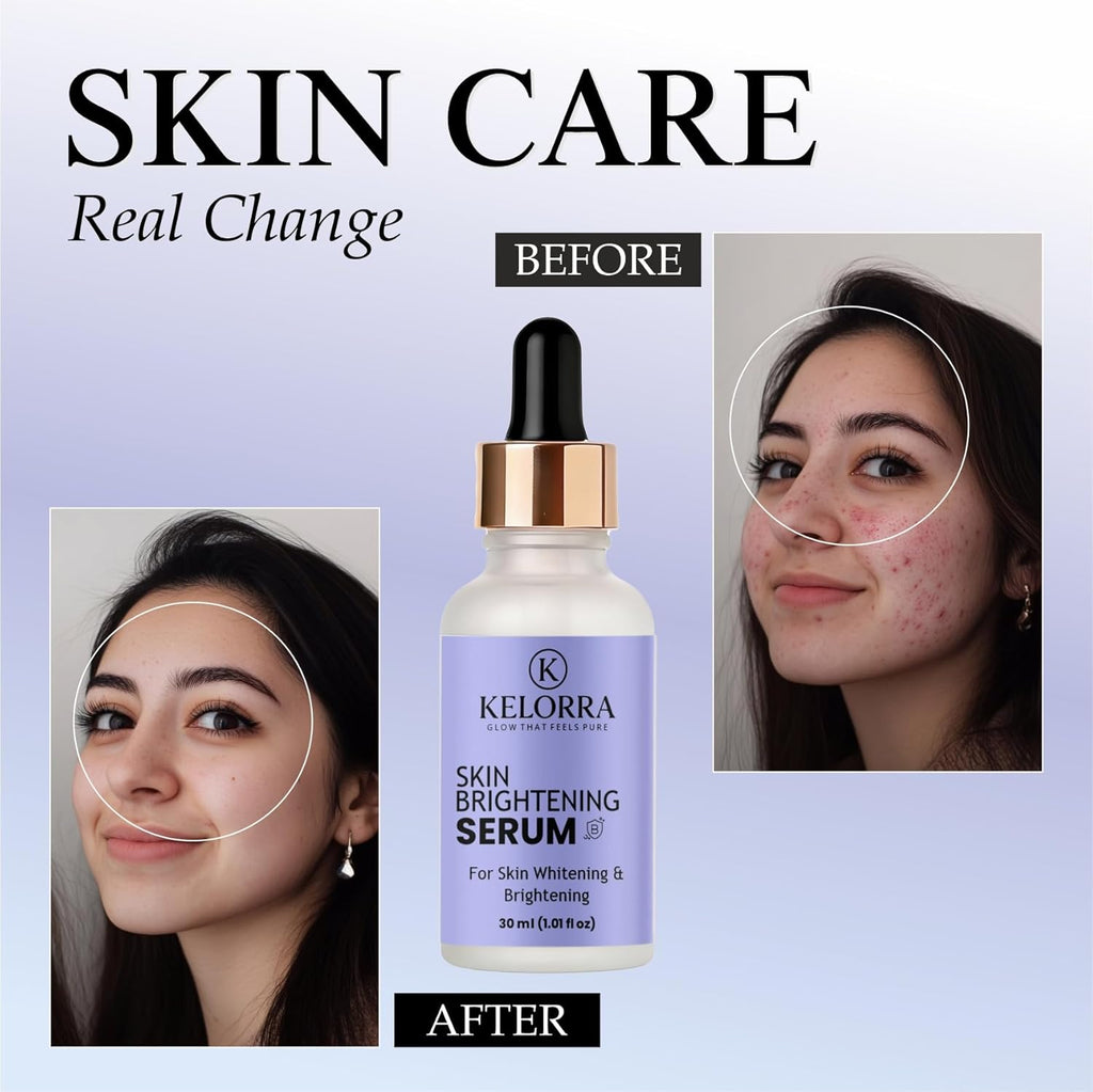 KELORRA Skin Brightening Serum for Whitening & Brightening, 30ml