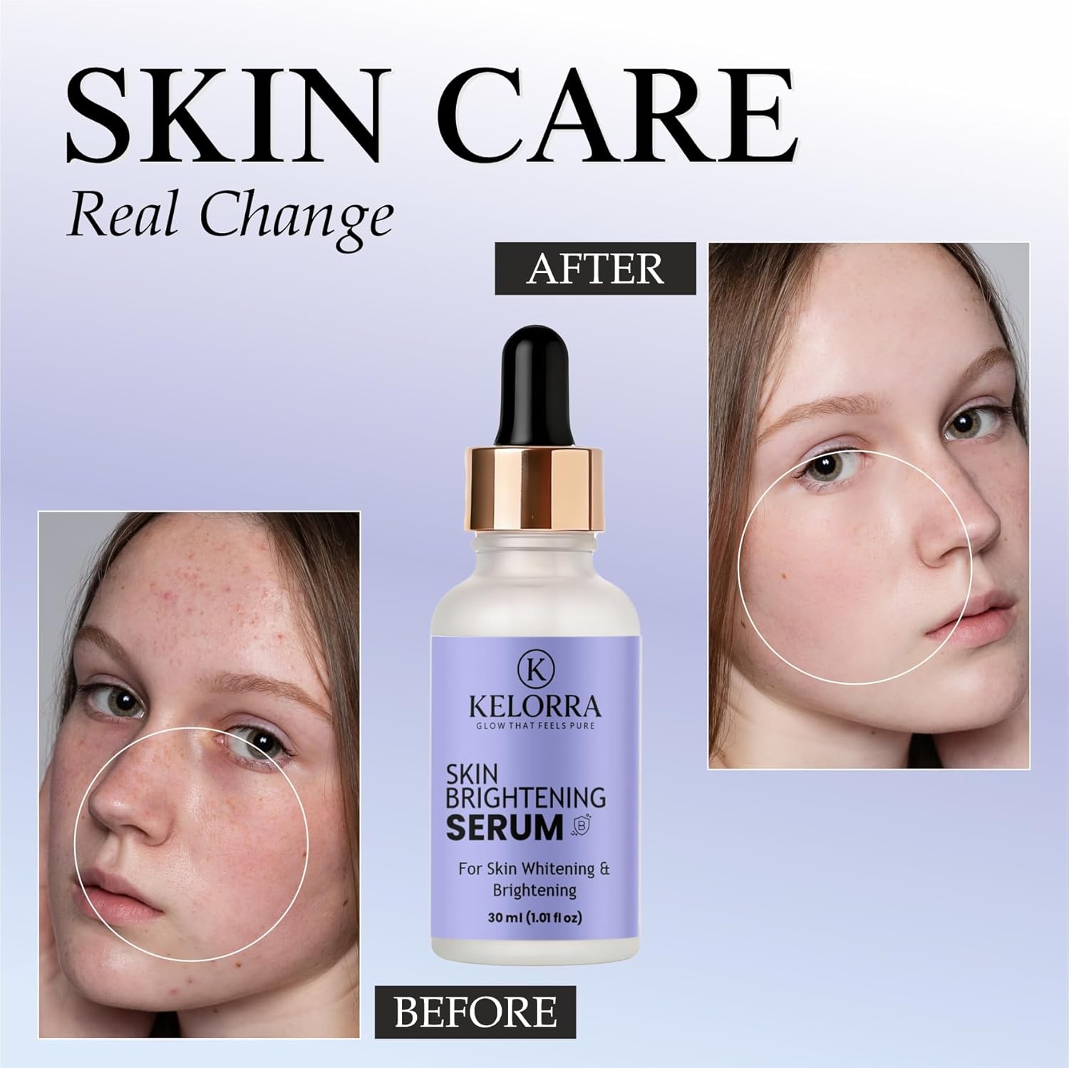 KELORRA Skin Brightening Serum for Whitening & Brightening, 30ml