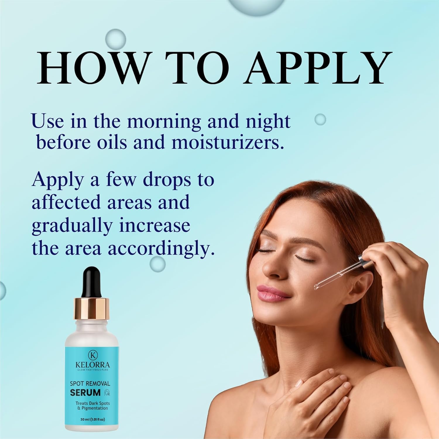 KELORRA Spot Removal Serum, Treats Dark Spots & Pigmentation, 30ml