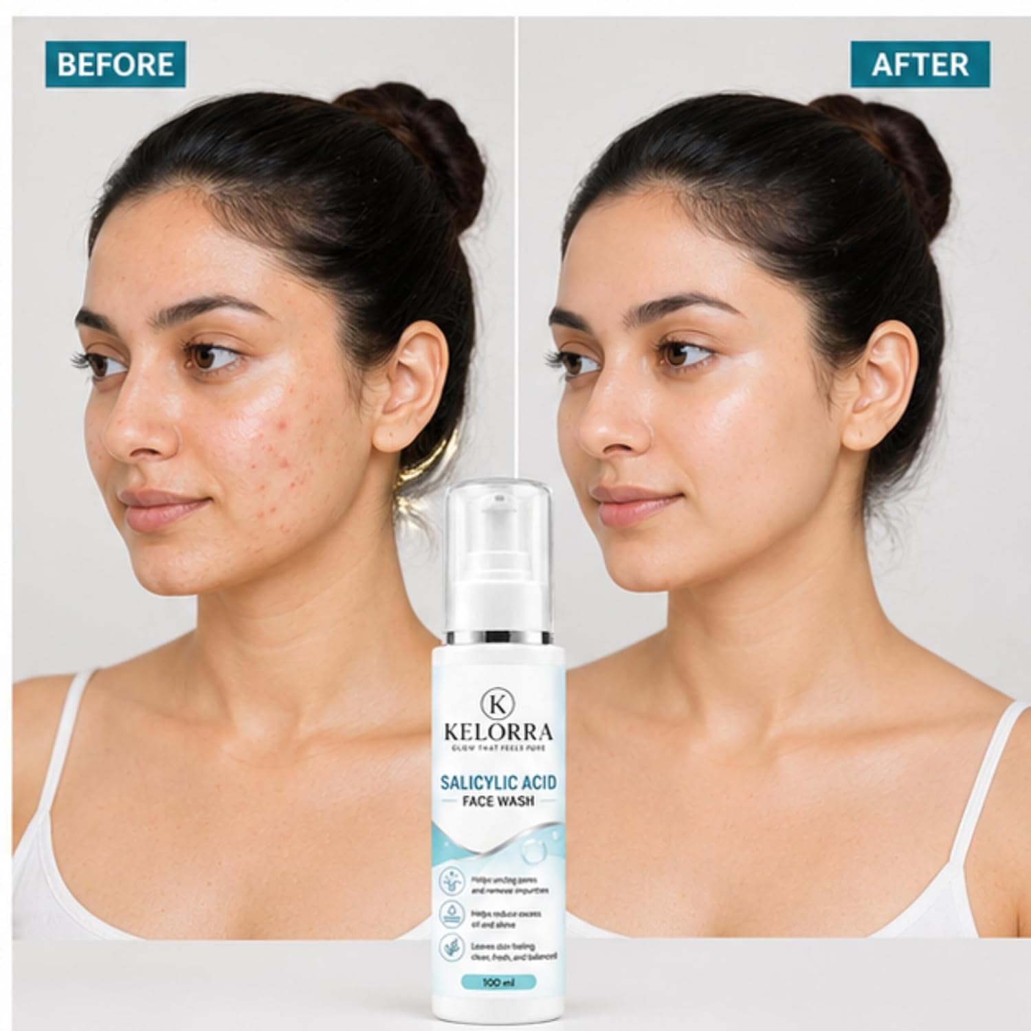 Kelorra 1% Salicylic Acid Face Wash | Daily Deep Cleansing Facial Cleanser | Helps Remove Dirt, Oil & Impurities | Refreshing Face Wash for Oily & Combination Skin | 100 ml