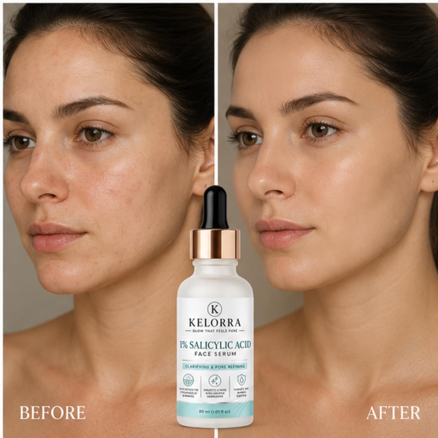 Kelorra 1% Salicylic Acid Face Serum | Clarifying & Pore Refining Serum | Lightweight Daily Skincare Formula | Suitable for Oily, Combination & Acne-Prone Skin | 30 ml